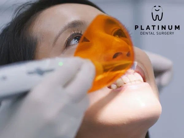 Dental Fillings