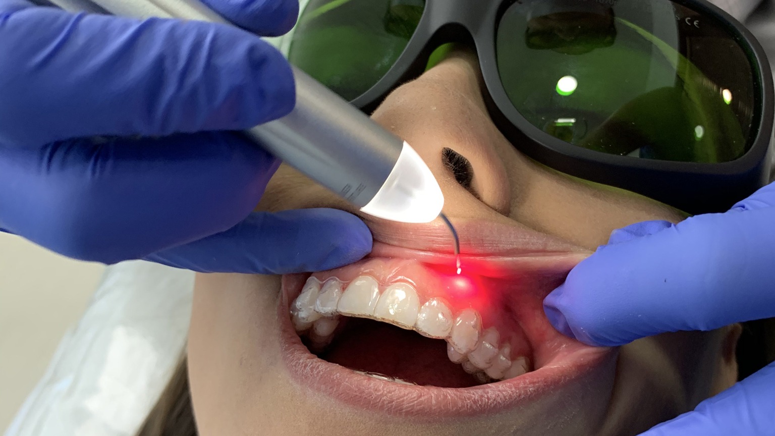 Laser Dentistry