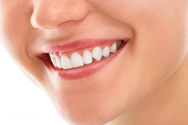 Veneers consultation
